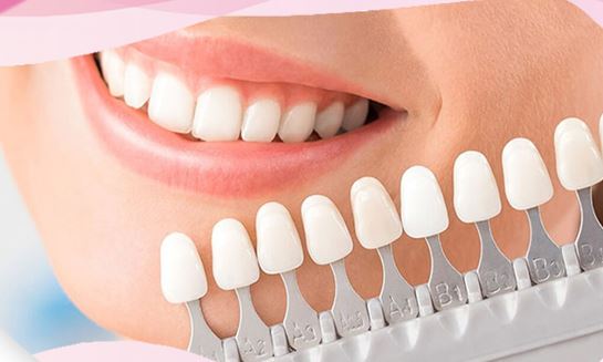 لمینیت دندان چیست؟ (3)