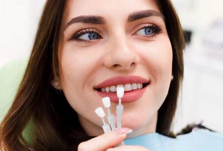 لمینیت دندان چیست؟