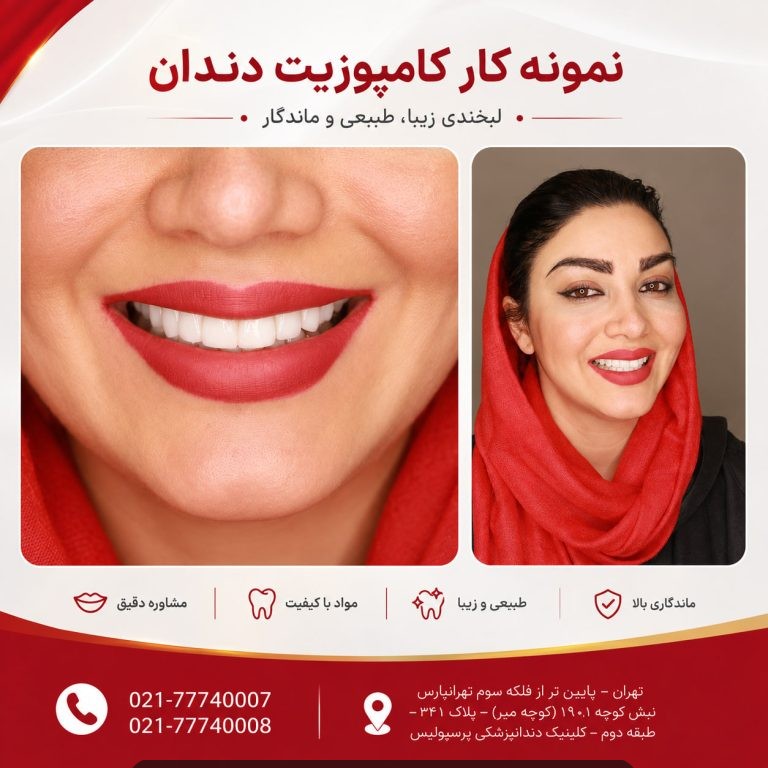 کامپوزیت دندان تهرانپارس
