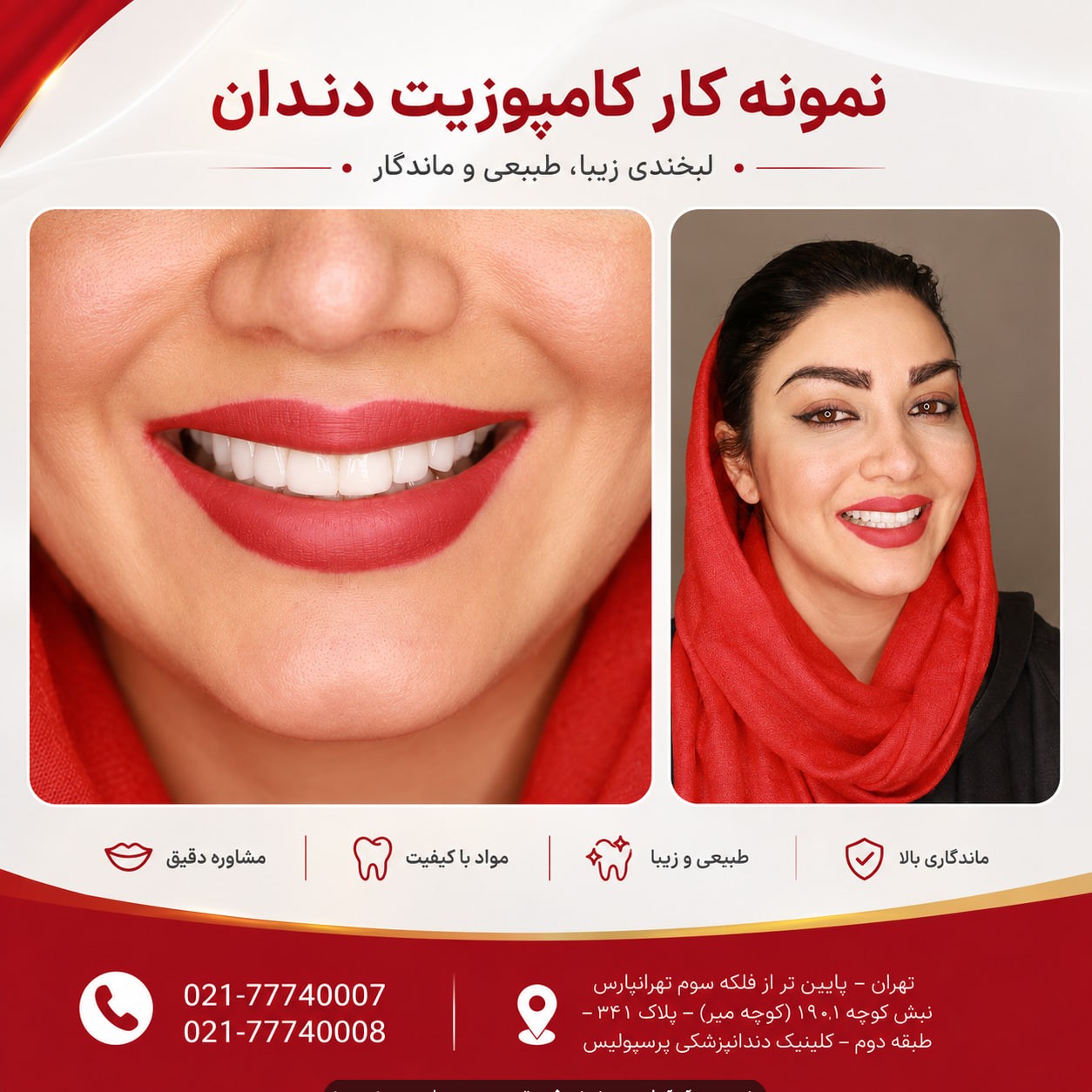 بهترین مرکز کامپوزیت دندان در تهرانپارس