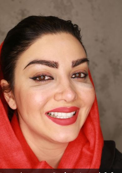 کامپوزیت دندان تهرانپارس